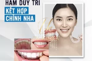Hàm duy trì kết quả chỉnh nha