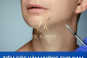 Tiêm góc hàm vuông cho nam