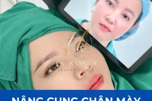 Nâng Cung Chân Mày