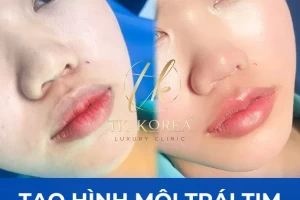 Tạo hình môi trái tim