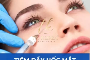 Tiêm đầy hốc mắt