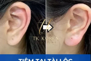 Tiềm tai tài lộc