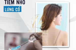 Tiêm Nhỏ Lưng Cổ